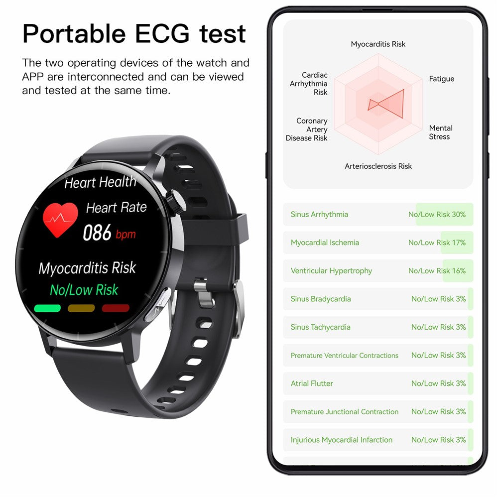 F67 Pro ECG Blood Sugar Uric Acid Monitoring Smart Watch 1.41-inch Round Sport Watch
