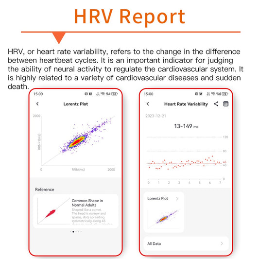 F400 Bluetooth-compatible Call Sports Watch ECG Blood Pressure Monitor Non-Invasive Blood Sugar Smart Watch, 3-Bead Steel Strap