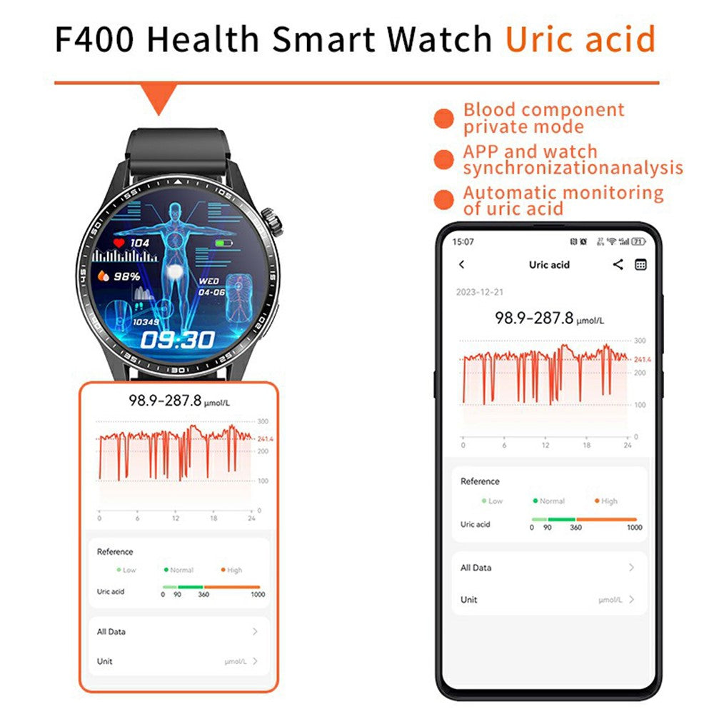 F400 Non-Invasive Blood Sugar Smart Watch ECG Blood Pressure Monitor Bluetooth-compatible Call Sports Watch, Silicone Strap